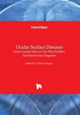 [预订]Ocular Surface Diseases - Some Current Date on Tear Film Problem and Keratoconic Diagnosis 9781838809591
