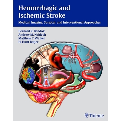 预订 Hemorrhagic and Ischemic Stroke: Medical, Imaging, Surgical and Interventional  Approaches 出血性与缺血性脑卒中: 97