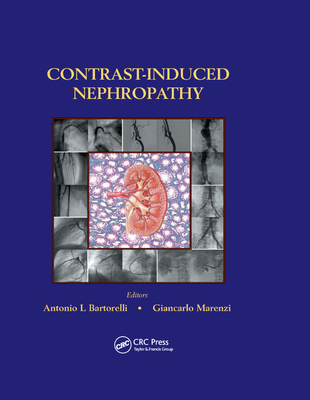【预订】Contrast-Induced Nephropathy in Interventional Cardiovascular Medicine