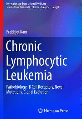 预订 Chronic Lymphocytic Leukemia