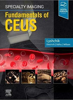 Specialty Imaging: Fundamentals of CEUS 专业影像：增强超声基础