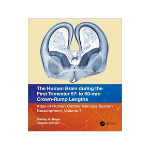 [预订]The Human Brain during the First Trimester 57- to 60-mm Crown-Rump Lengths 9781032185668