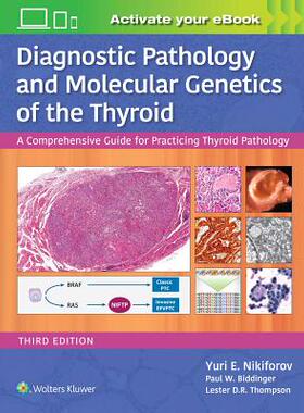 【预订】Diagnostic Pathology and Molecular Genetics of the Thyroid