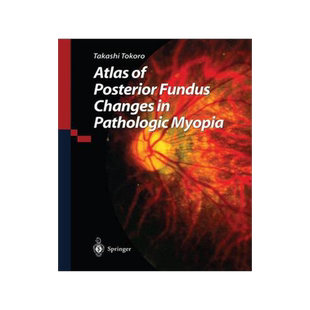 预订 Atlas of Posterior Fundus Changes in Pathologic Myopia