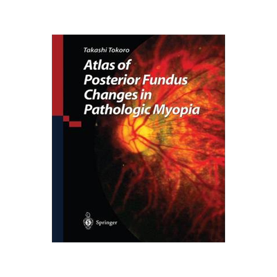 预订 Atlas of Posterior Fundus Changes in Pathologic Myopia