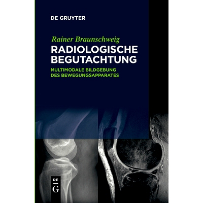 预订 Radiologische Begutachtung: Multimodale Bildgebung des Bewegungsapparates: 9783110517934