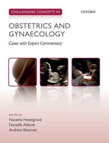 【预订】Challenging Concepts in Obstetrics and Gynaecology