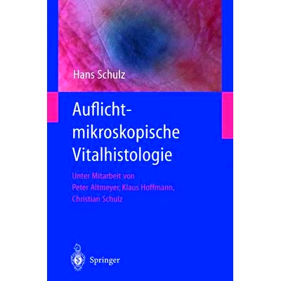 预订 Auflichtmikroskopische Vitalhistologie: Dermatologischer Leitfaden: 9783540422112