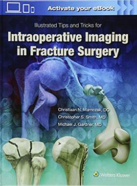 【预订】Illustrated Tips and Tricks for Intraoperative Imaging in Fracture Surgery