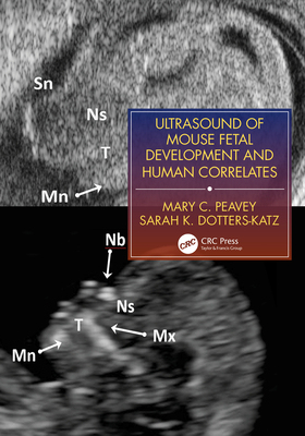 【预订】Ultrasound of Murine Fetal Development with Human Correlation