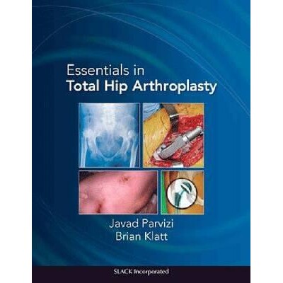 预订 Essentials in Total Hip Arthroplasty 全髋关节置换术要点 9781556428708