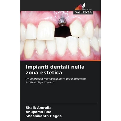 预订 Impianti dentali nella zona estetica: Un approccio multidisciplinare per il successo estetico degli impianti. DE: 9