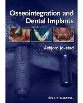 【预订】Osseointegration and Dental Implants