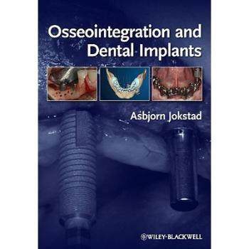 【预订】Osseointegration and Dental Implants