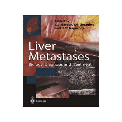 预订 Liver Metastases