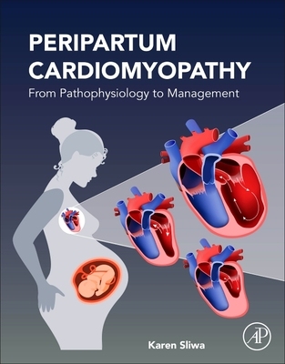 【预订】Peripartum Cardiomyopathy: From Pathophysiology to Management