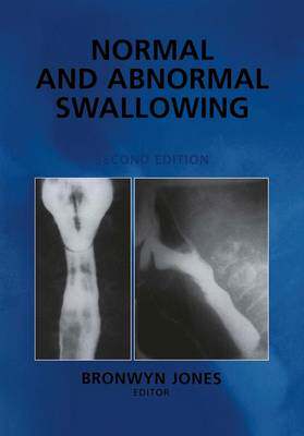【预订】Normal and Abnormal Swallowing