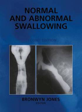 【预订】Normal and Abnormal Swallowing