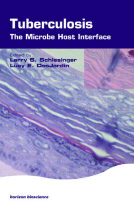 【预订】Tuberculosis