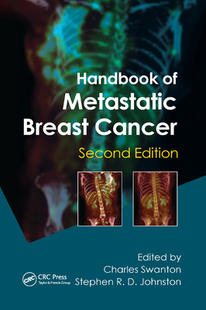预订 Breast Handbook Metastatic Cancer