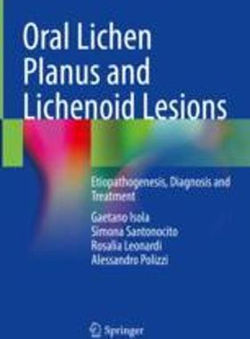[预订]Oral Lichen Planus and Lichenoid Lesions: Etiopathogenesis, Diagnosis and Treatment 9783031297649