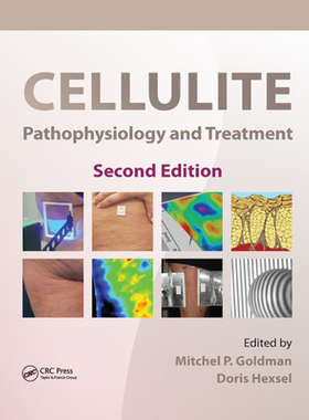 【预订】Cellulite