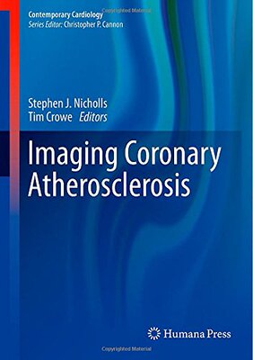 【预订】Imaging Coronary Atherosclerosis