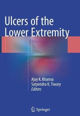 预订 Ulcers of the Lower Extremity