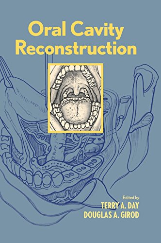 【预订】Oral Cavity Reconstruction