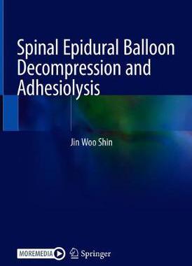 【预订】Spinal Epidural Balloon Decompression and Adhesiolysis