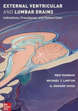 [预订]External Ventricular and Lumbar Drains: Indications, Procedures, and Patient Care 9781264268290