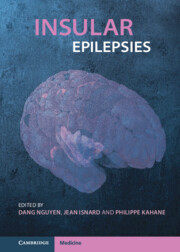 【预订】Insular Epilepsies 9781108772402