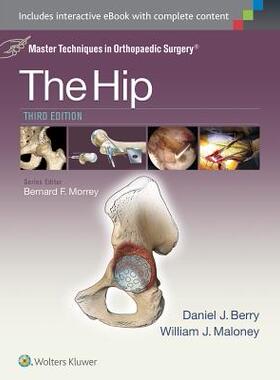 【预订】Master Techniques in Orthopaedic Surgery