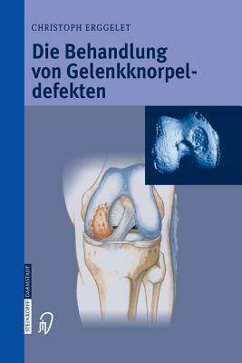 预订 Die Behandlung von Gelenkknorpeldefekten
