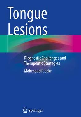 [预订]Tongue Lesions 9783031082009