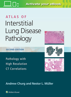 【预订】Atlas of Interstitial Lung Disease Pathology