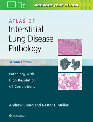 【预订】Atlas of Interstitial Lung Disease Pathology