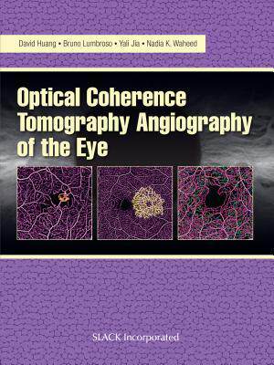[预订]Optical Coherence Tomography Angiography of the Eye 9781630912826