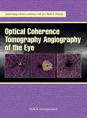 [预订]Optical Coherence Tomography Angiography of the Eye 9781630912826