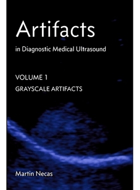 预订 Artifacts in Diagnostic Medical Ultrasound: Grayscale Artifacts: 9780987292162
