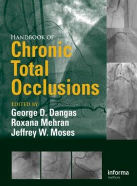 【预订】Handbook of Chronic Total Occlusions