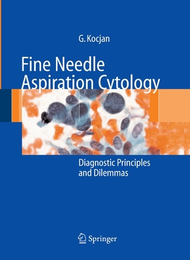 【预订】Fine Needle Aspiration Cytology