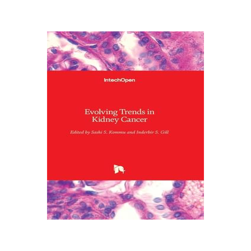 [预订]Evolving Trends in Kidney Cancer 9781838819590