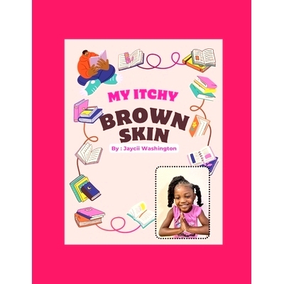 预订 My Itchy Brown Skin: 9798864325520