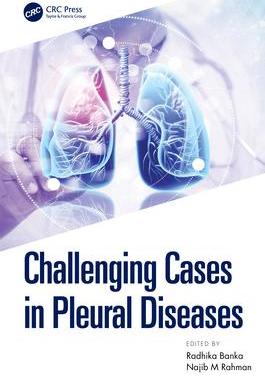 [预订]Challenging Cases in Pleural Diseases 9780367533717