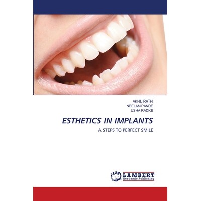 预订 Esthetics in Implants: 9786202673068