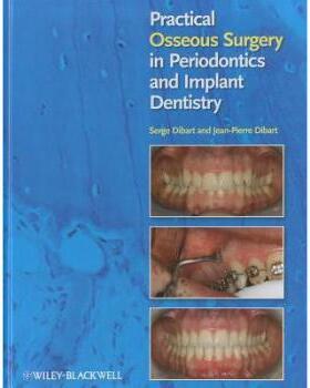 【预售】Practical Osseous Surgery in Periodontics and Implant Dentistry