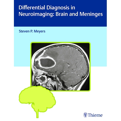 预订 Differential Diagnosis in Neuroimaging: Brain and Meninges 神经成像中的鉴别诊断：脑和脑膜: 9781604067002
