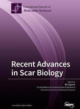 [预订]Recent Advances in Scar Biology 9783038973980
