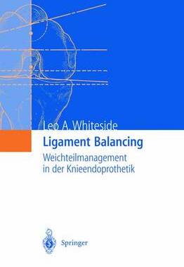 预订 Ligament Balancing